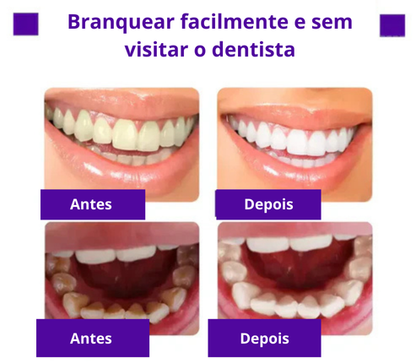 Pasta de Dentes V34