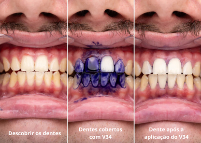 Pasta de Dentes V34