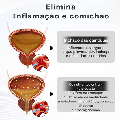 Cuidados com a próstata Inalador de terapia nasal